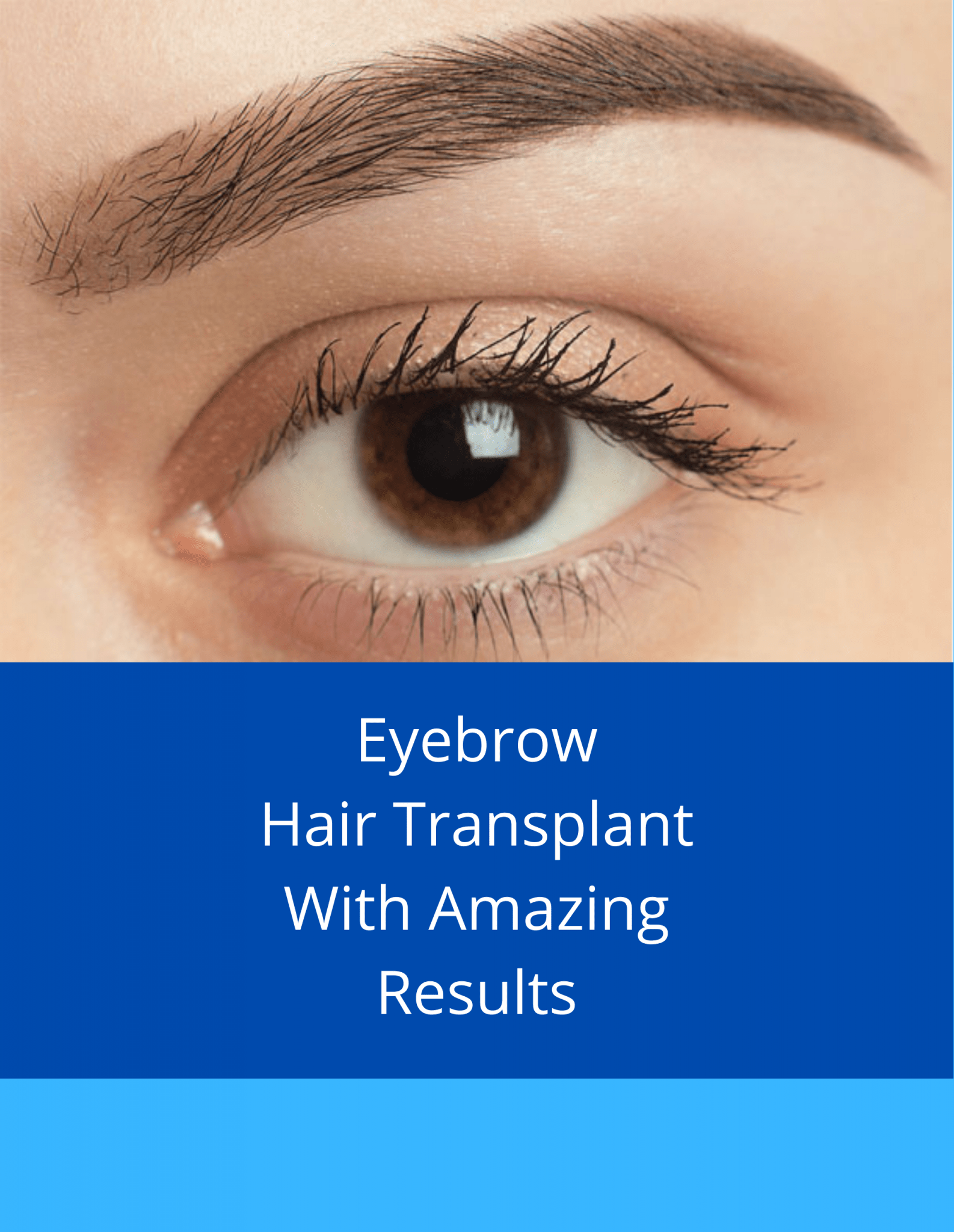 Eyebrow Reconstruction Spiral Skin And Hair Transplant Centre
